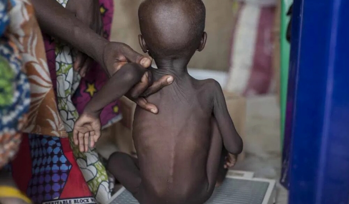 Nigeria’s Child Stunting Hits 40% as Athena Centre Demands Nutrition Accountability